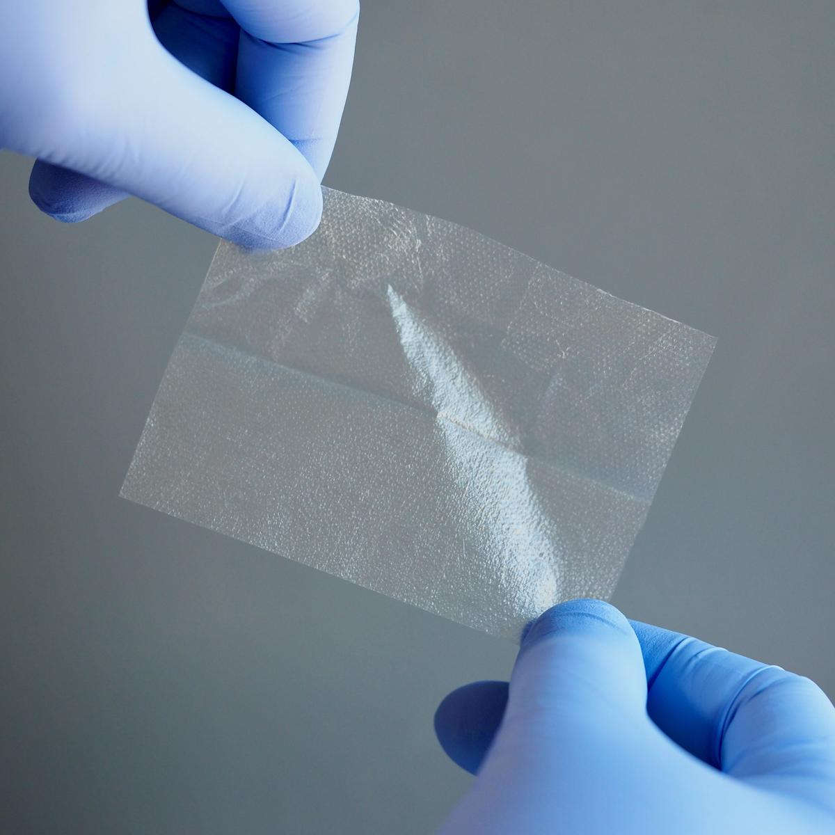 Amniotic membrane patch — gloved hands
